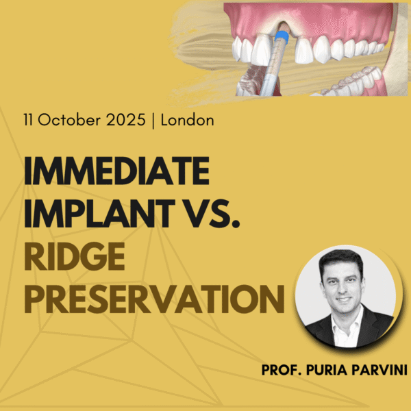 Immediate Implants vs Ridge Preservation Course in London